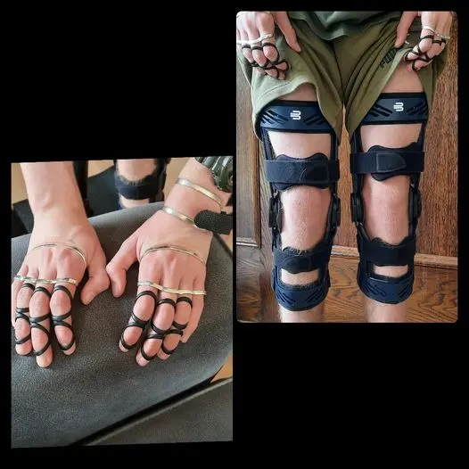 Nieks handen met silversplints om de vingers en zijn knieën in zwarte kniebraces